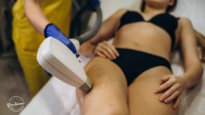 Best Laser Hair Removal in Vancouver