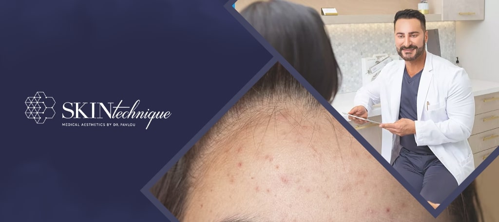 Skin Technique Downtown Vancouver