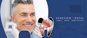 Parkview Dental and Implant Center