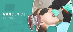 Van Dental Clinic