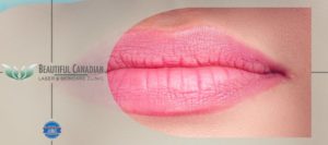 Beautiful Canadian Laser & Skincare Clinic