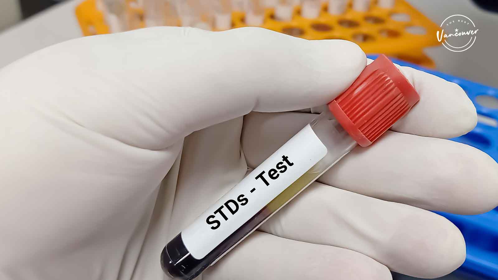 Best STD Testing Clinics in Vancouver