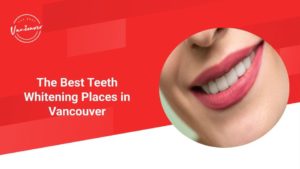 The 5 Best Teeth Whitening Places in Vancouver