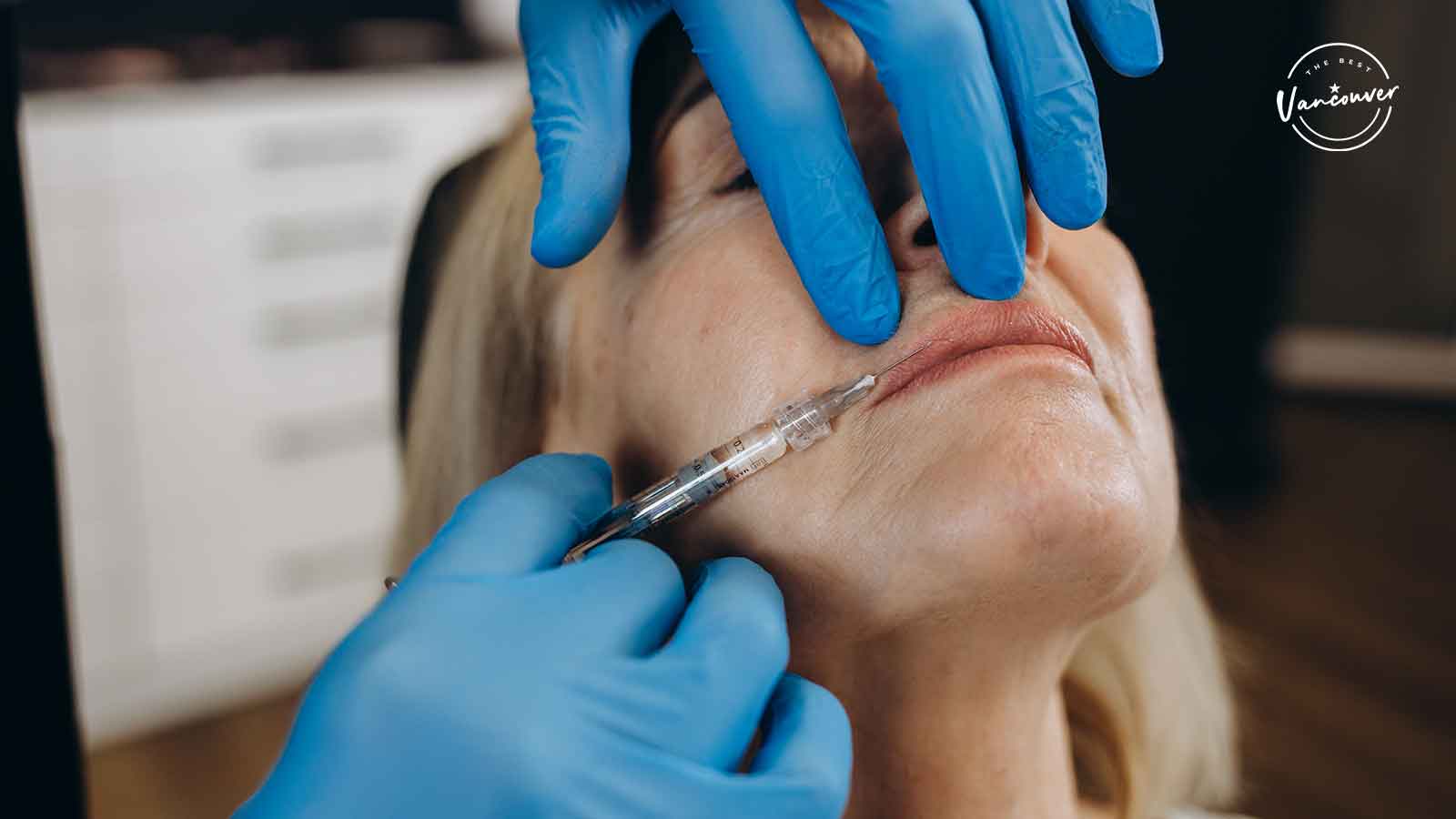 Best Dermal Fillers in Vancouver