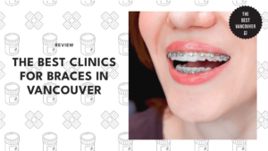 5 BEST CLINICS FOR BRACES IN VANCOUVER