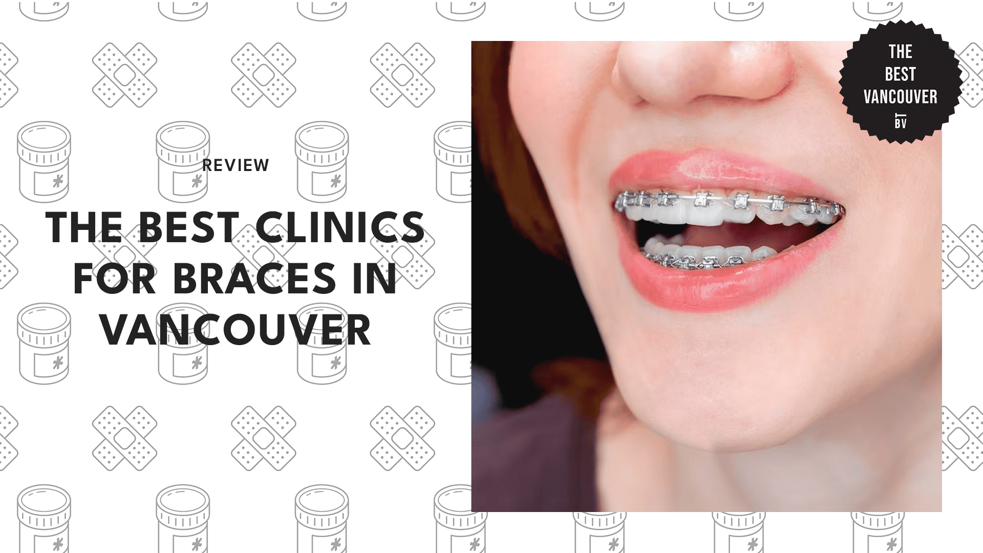 5 BEST CLINICS FOR BRACES IN VANCOUVER