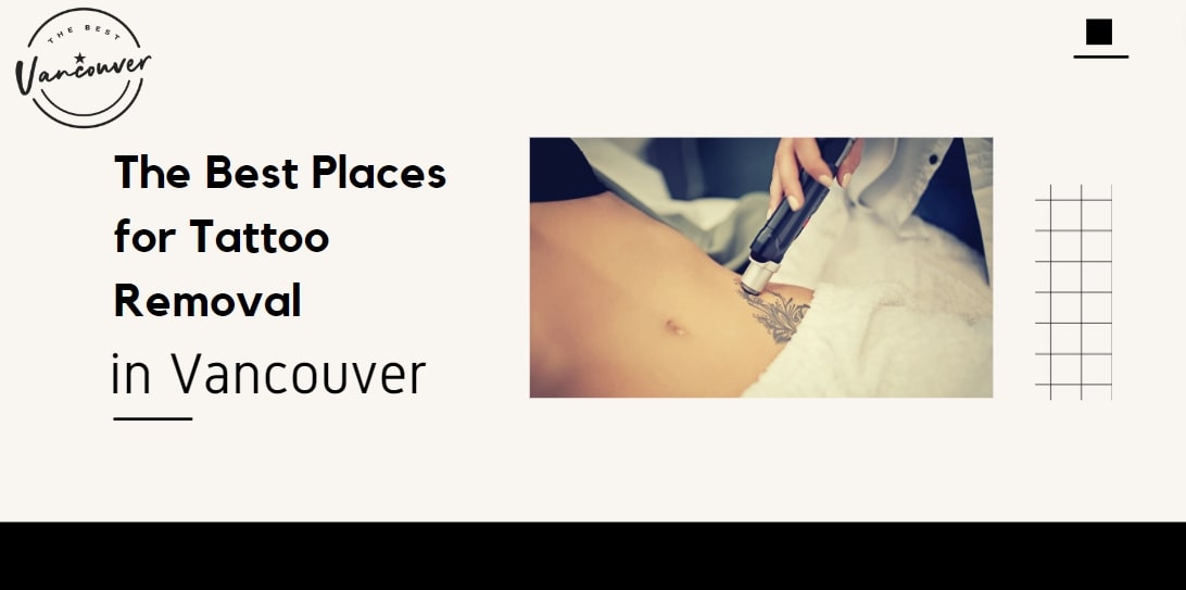 5 Best Places for Tattoo Removal in Vancouver