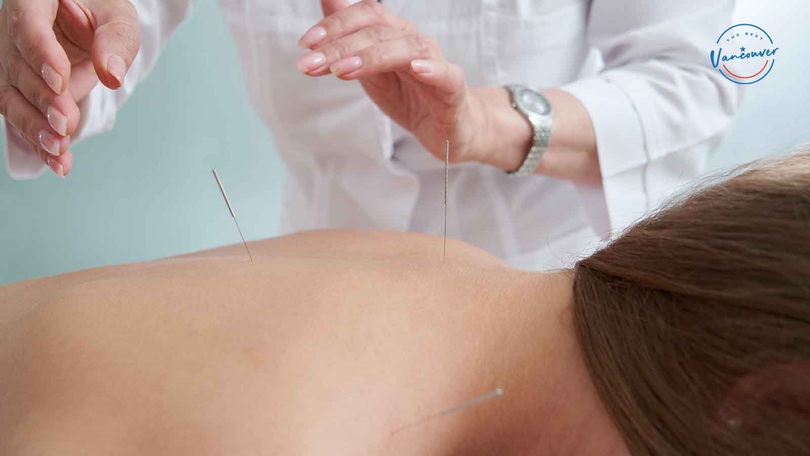Best Acupuncture Clinics in Vancouver