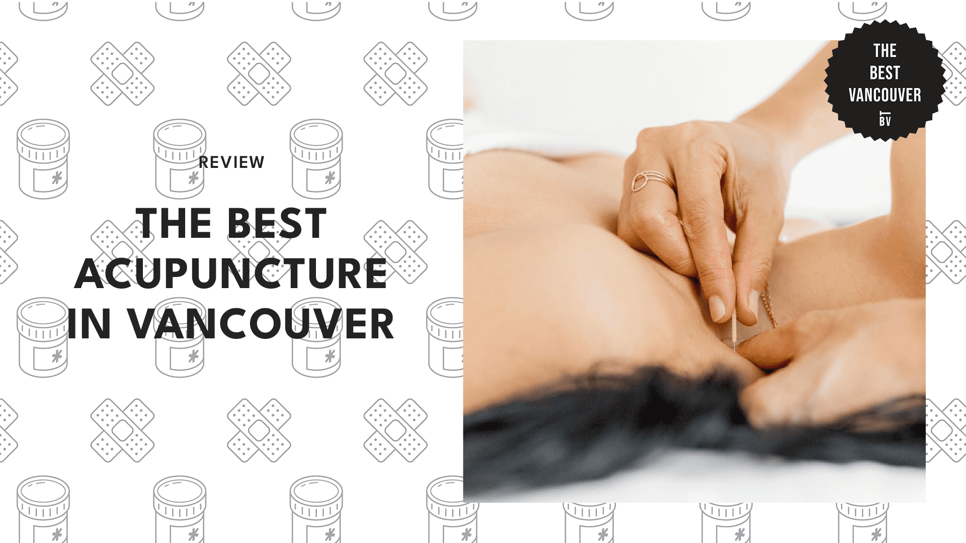 17 BEST ACUPUNCTURE CLINICS IN VANCOUVER