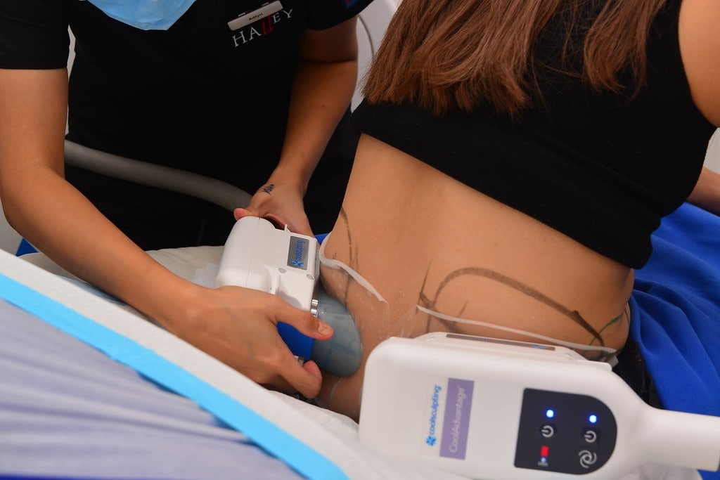 How does CoolSculpting work
