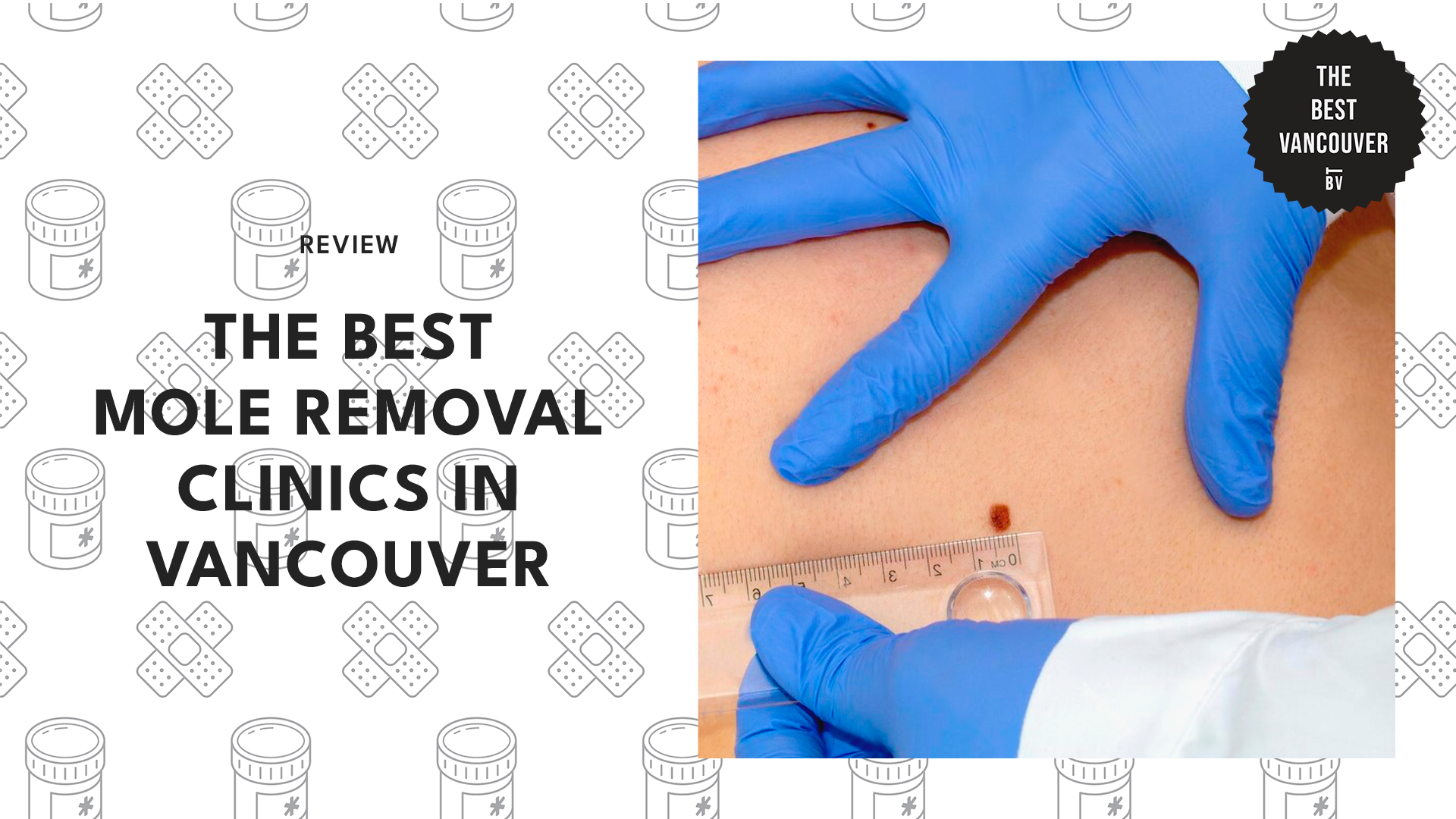 mole-removal-vancouver-banner
